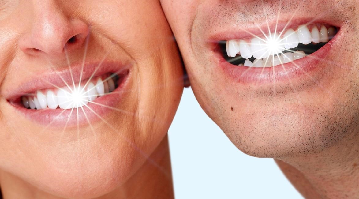 consider teeth whitening