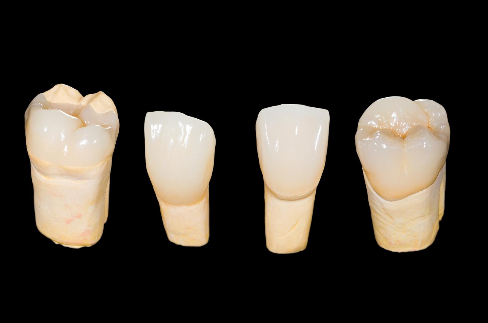 Dental Implant Materials